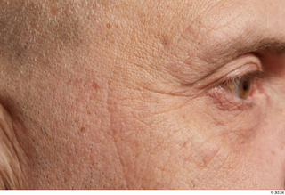  HD Face skin references Saahir Nasir cheek eye pores skin texture wrinkles 0001.jpg